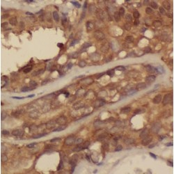 Clathrin Interactor 1 (CLINT1) Antibody