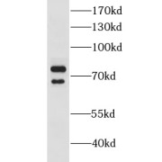 WB analysis of HeLa cells, using CLINT1 antibody (1/1000 dilution).