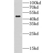 WB analysis of SH-SY5Y cells, using CLN3 antibody (1/800 dilution).