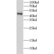 WB analysis of mouse testis tissue, using CLP1 antibody (1/600 dilution).