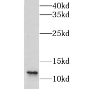 WB analysis of mouse pancreas tissue, using CLPS antibody (1/600 dilution).