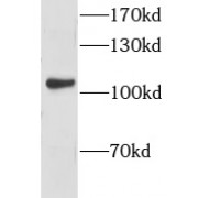 WB analysis of human brain tissue, using CLSTN1 antibody (1/600 dilution).