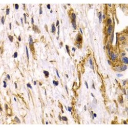 Clusterin (CLU) Antibody