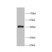 WB analysis of Y79 cells, using CLU antibody (1/1000 dilution).