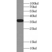 WB analysis of human blood tissue, using CLU antibody (1/1000 dilution).