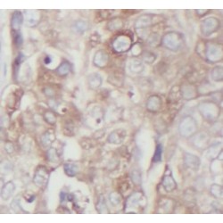 Hepatocyte Growth Factor Receptor (c-Met) Antibody