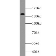 WB analysis of HeLa cells, using MET antibody (1/500 dilution).