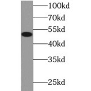 WB analysis of Raji cells, using MYC antibody (1/1000 dilution).