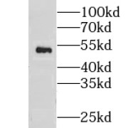 WB analysis of PC-3 cells, using CNDP2 antibody (1/200 dilution).