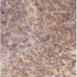 Metal Transporter CNNM3 (CNNM3) Antibody