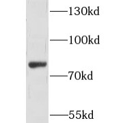 WB analysis of K-562 cells, using CNNM3 antibody (1/500 dilution).