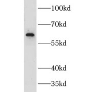 abx231807