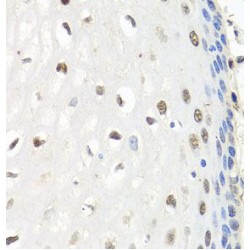 CCR4-NOT Transcription Complex Subunit 8 (CNOT8) Antibody