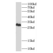 WB analysis of HeLa cells, using CNPY4 antibody (1/1000 dilution).