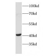 WB analysis of mouse brain tissue, using CNTFR antibody (1/1000 dilution).