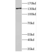 WB analysis of rat brain tissue, using CNTN1 antibody (1/1200 dilution).