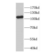 abx231822