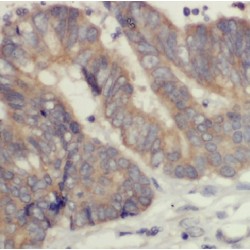 Coenzyme A Synthase (COASY) Antibody