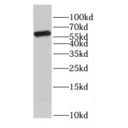 WB analysis of HeLa cells, using COASY antibody (1/500 dilution).