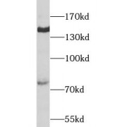 WB analysis of Mouse liver tissue, using COL2A1 antibody (1/500 dilution).