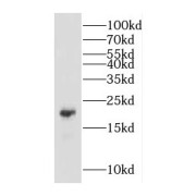 WB analysis of human liver tissue, using COMMD1 antibody (1/1000 dilution).