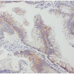 Gap Junction Beta-2 Protein / CX26 (GJB2) Antibody