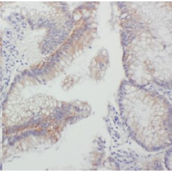 Gap Junction Beta-1 Protein / CX32 (GJB1) Antibody