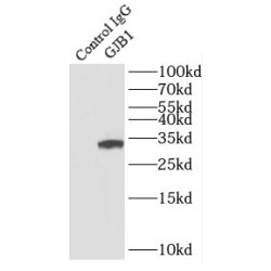 Gap Junction Beta-1 Protein / CX32 (GJB1) Antibody