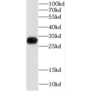 WB analysis of mouse brain tissue, using GJB1 antibody (1/300 dilution).