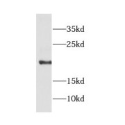 WB analysis of K-562 cells, using COPZ1 antibody (1/500 dilution).