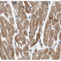 Coenzyme Q6, Monooxygenase (COQ6) Antibody