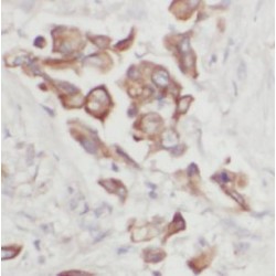 Cytochrome C Oxidase Subunit 5A (COX5A) Antibody