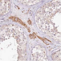 Cytochrome C Oxidase Subunit 6B2 (COX6B2) Antibody