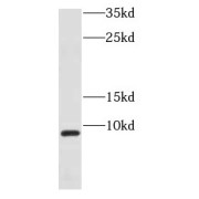 WB analysis of human skeletal muscle tissue, using COX7B antibody (1/400 dilution).