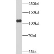 WB analysis of HeLa cells, using CP110 antibody (1/400 dilution).