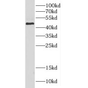 WB analysis of mouse pancreas tissue, using PASP antibody (1/1000 dilution).