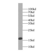 WB analysis of HepG2 cells, using CPI17 antibody (1/1000 dilution).