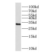 WB analysis of SMMC-7721 cells, using CPPED1 antibody (1/300 dilution).
