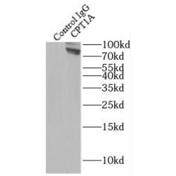 Carnitine Palmitoyltransferase 1A, Liver (CPT1A) Antibody
