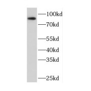 WB analysis of HepG2 cells, using CPT1A antibody (1/1000 dilution).