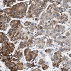 Carboxypeptidase, Vitellogenic Like (CPVL) Antibody
