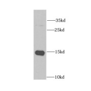 WB analysis of HeLa cells, using CRABP2 antibody (1/1000 dilution).