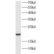 WB analysis of Raji cells, using CRCP antibody (1/1000 dilution).