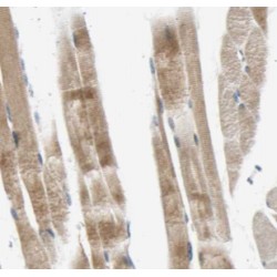Creatine Kinase MM-Specific Antibody