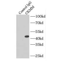 Creatine Kinase MM-Specific Antibody