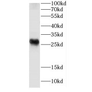 WB analysis of mouse heart tissue, using CRIP2 antibody (1/1500 dilution).