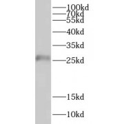 WB analysis of human testis tissue, using CRISP2 antibody (1/800 dilution).