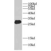 WB analysis of human placenta tissue, using CRISP3 antibody (1/300 dilution).