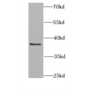 WB analysis of MCF7 cells, using CRK antibody (1/1000 dilution).
