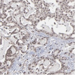 Luc7-Like Protein 3 (LUC7L3) Antibody